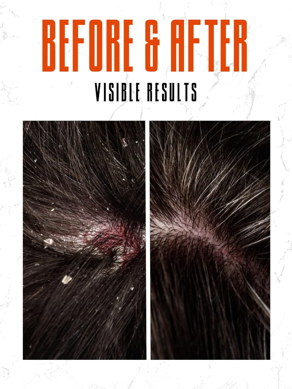 AQ ORGANIC ANTI DRYNESS HAIR OIL