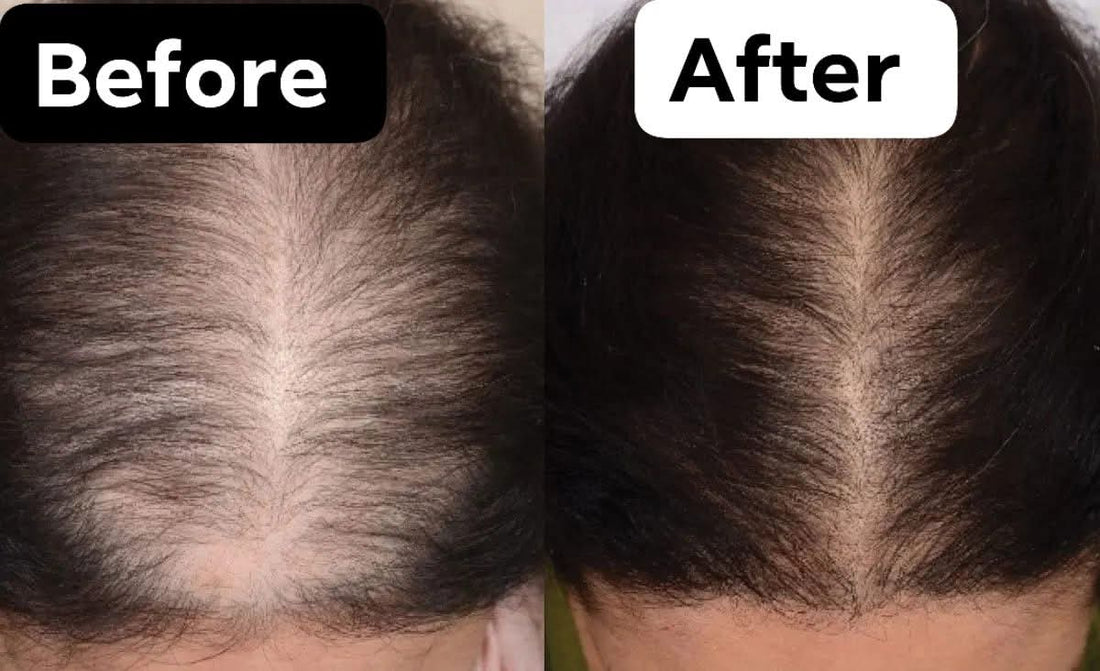 AQ ORGANIC ANTI HAIRFALL  OIL